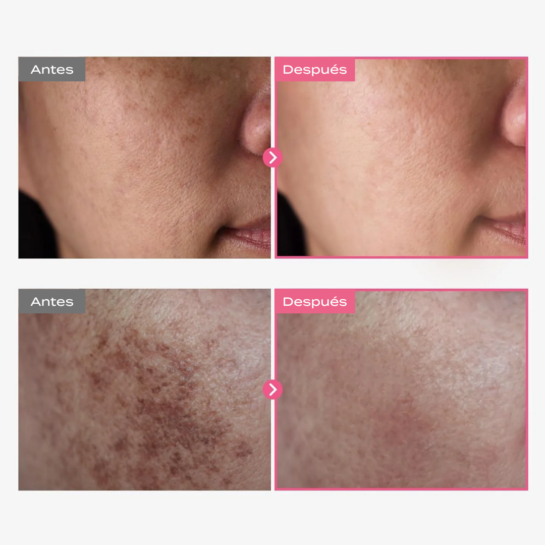 Crema antimanchas Zephyra Arbutina 7%